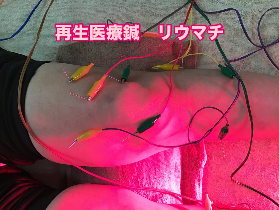 画像720